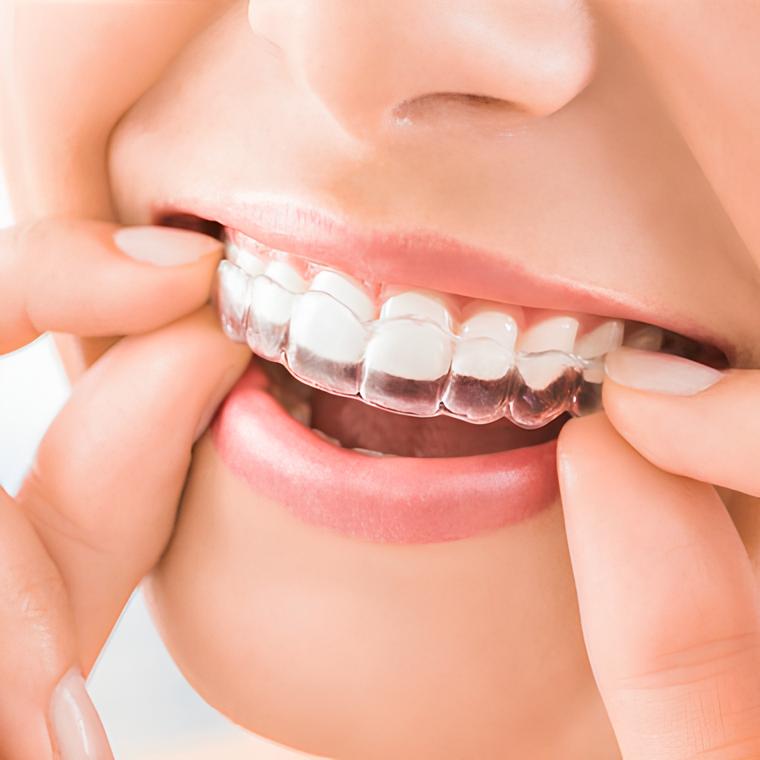 Invisalign in Astoria, Queens